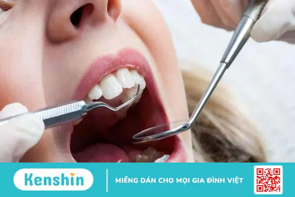 Triệu chứng và cách điều trị áp xe quanh chóp răng 3