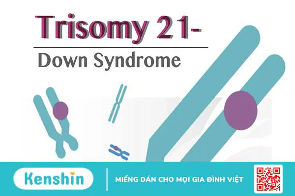 Trisomy 21 là gì? Kết quả chỉ số Trisomy 21 bao nhiêu là bình thường?