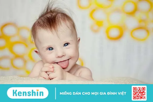 Trisomy 21 là gì? Kết quả chỉ số Trisomy 21 bao nhiêu là bình thường?