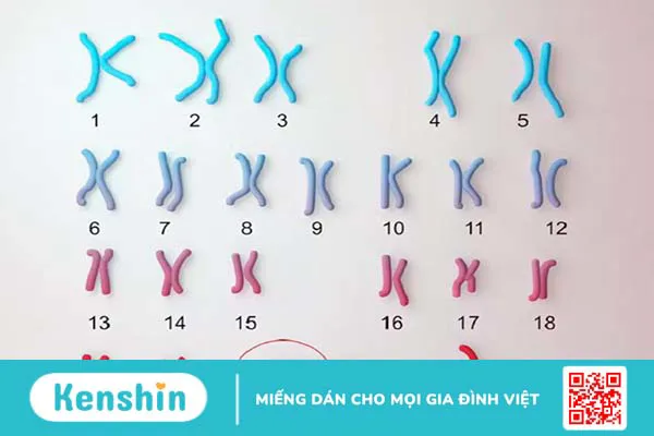 Trisomy 21 là gì? Kết quả chỉ số Trisomy 21 bao nhiêu là bình thường?