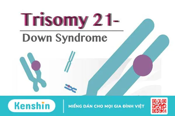 Trisomy 21 là gì? Kết quả chỉ số Trisomy 21 bao nhiêu là bình thường?