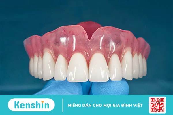 Trồng răng cấm giá bao nhiêu? Nên chọn phương pháp nào? 2