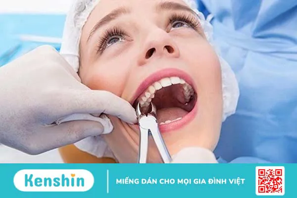 Trồng răng cấm giá bao nhiêu? Nên chọn phương pháp nào? 3