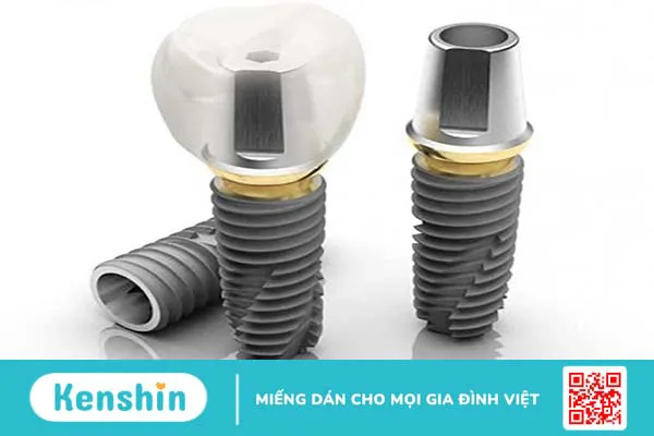 Osstem implant có thật sự hiệu quả ?