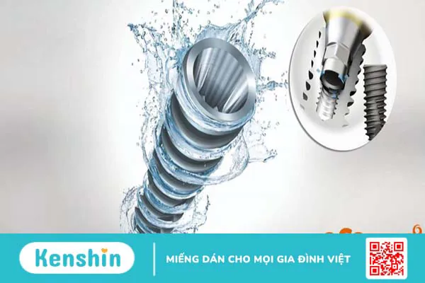 Osstem implant có thật sự hiệu quả ?