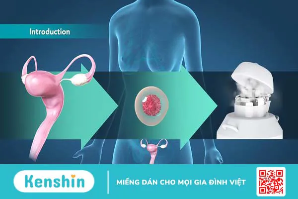 Trữ đông noãn là gì? Quy trình và chi phí thực hiện