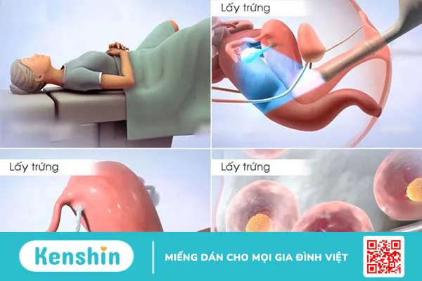 Trữ đông noãn là gì? Quy trình và chi phí thực hiện