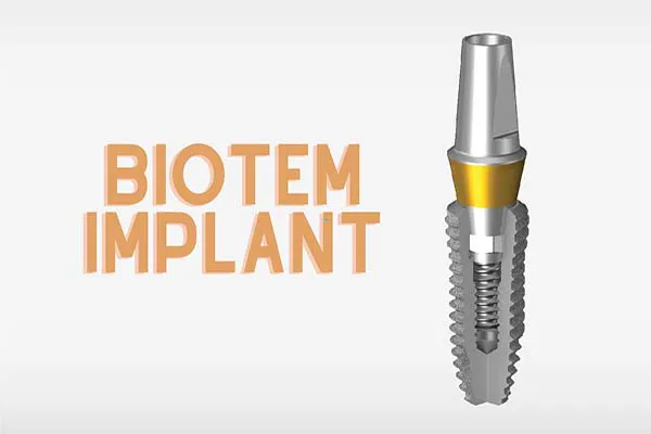 Trụ răng Biotem Implant và những điều cần biết