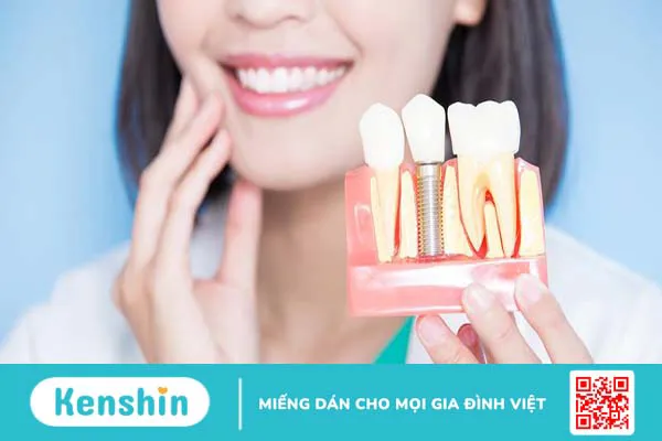 Trụ răng Biotem Implant và những điều cần biết