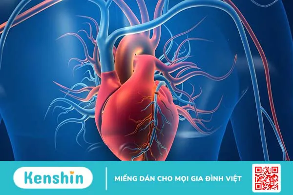 Trường hợp nào cần chụp mạch vành qua da?