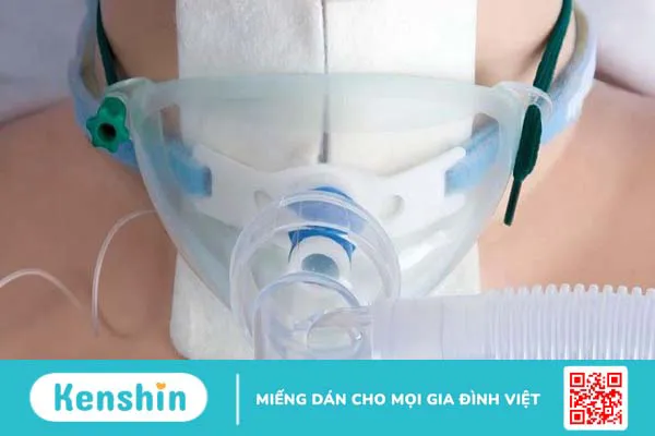 Trường hợp nào cần thực hiện phẫu thuật mở khí quản?