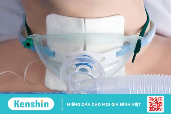 Trường hợp nào cần thực hiện phẫu thuật mở khí quản?