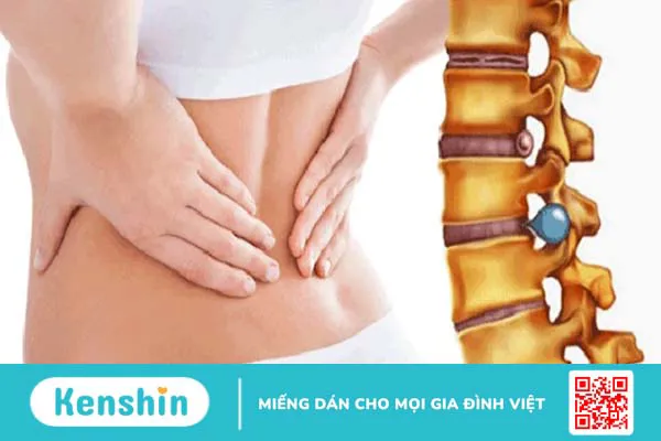 Tự chữa thoát vị đĩa đệm bằng các phương pháp dân gian tại nhà