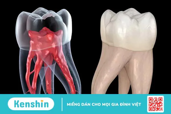 Tủy răng là gì? Tủy răng quan trọng đến mức nào?