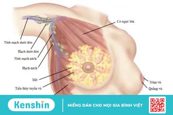 Tuyến vú phụ ở nách là gì? Biểu hiện của tuyến vú phụ