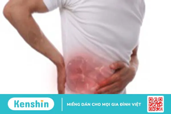 U cơ mỡ mạch thận là gì? Các dấu hiệu nhận biết u cơ mỡ mạch thận