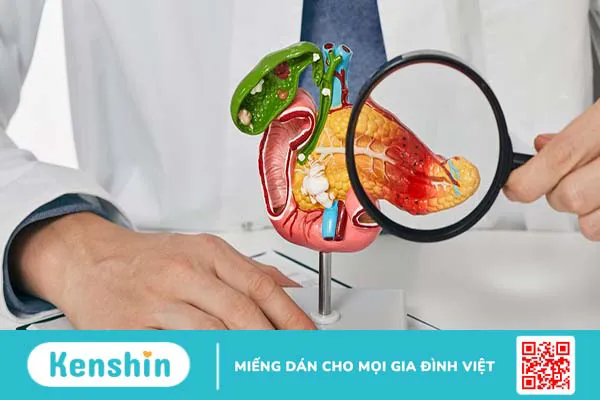 U đầu tụy có nguy hiểm không? U đầu tụy điều trị thế nào?