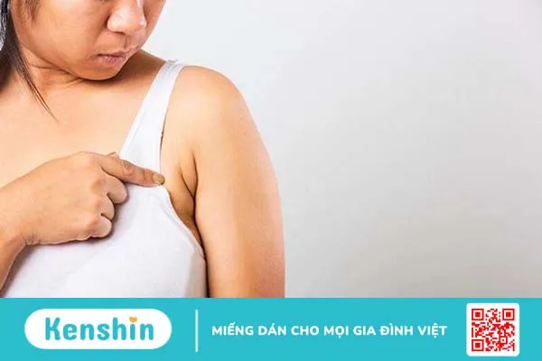 U mỡ nách có nguy hiểm không? Điều trị như thế nào?