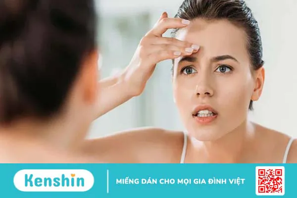 U mỡ ở trán là gì? Dấu hiệu nhận biết u mỡ ở trán