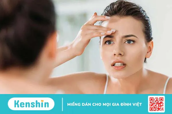 U mỡ ở trán là gì? Cách nhận biết và phương pháp điều trị? 1