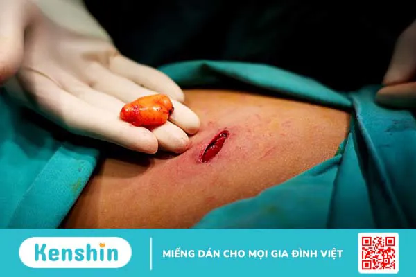 U mỡ sau gáy là gì? Có nguy hiểm không?