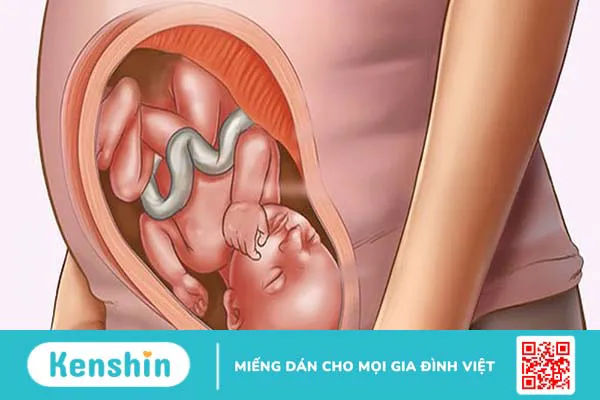 U sắc tố bẩm sinh ở trẻ em: Nguyên nhân, triệu chứng và cách điều trị 4