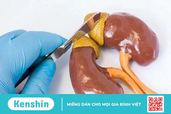 U tuyến thượng thận là gì? Nguyên nhân và cách điều trị