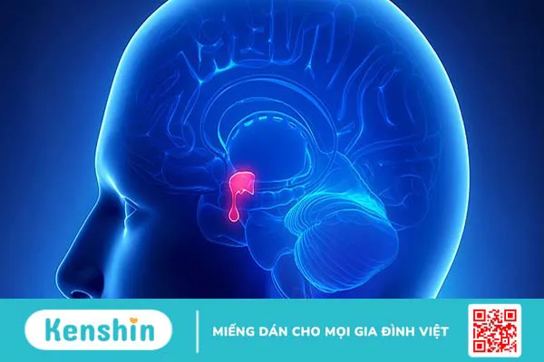 U tuyến yên tăng tiết prolactin là gì và cách điều trị hiệu quả