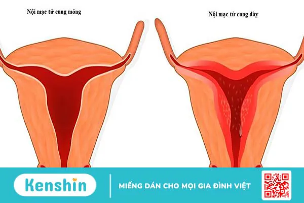 Uống nước cam có làm mỏng niêm mạc không?