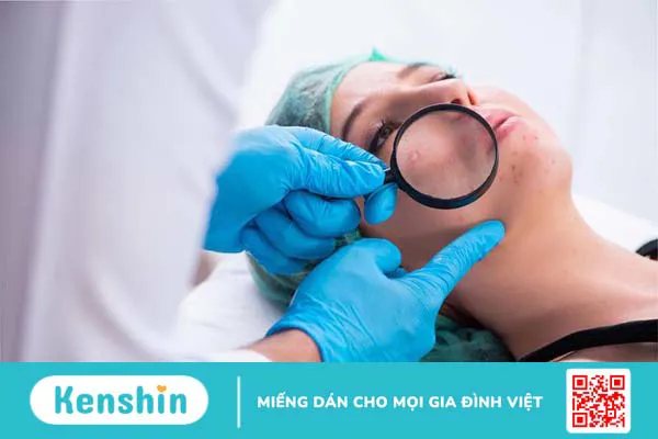 Uống thải độc gan có hết mụn không?