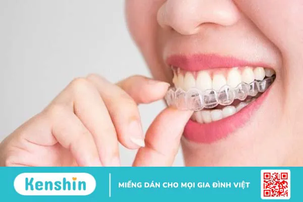 Ưu điểm khi chọn niềng răng Ecligner