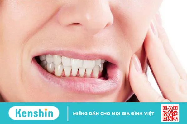 Ưu điểm khi chọn niềng răng Ecligner