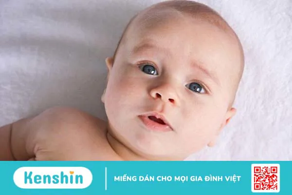 Vẹo cổ bẩm sinh: Nguyên nhân, triệu chứng nhận biết và cách điều trị bệnh 2