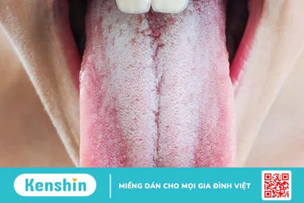 Vị giác là gì? Một số rối loạn vị giác thường gặp