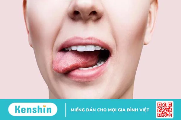 Vị giác là gì? Một số rối loạn vị giác thường gặp