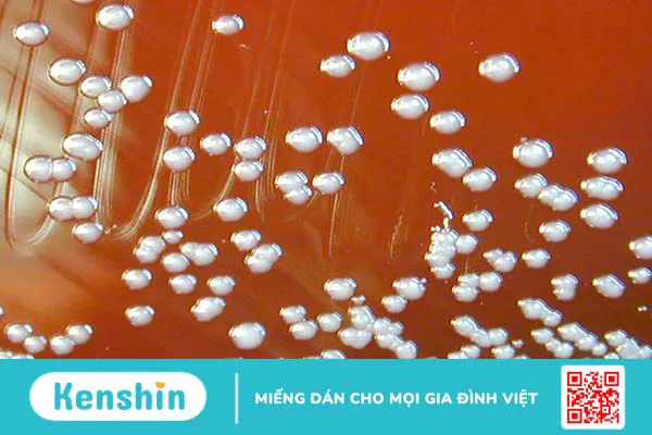 Vi khuẩn Burkholderia cepacia - Mầm bệnh gây nhiễm trùng bệnh viện 2