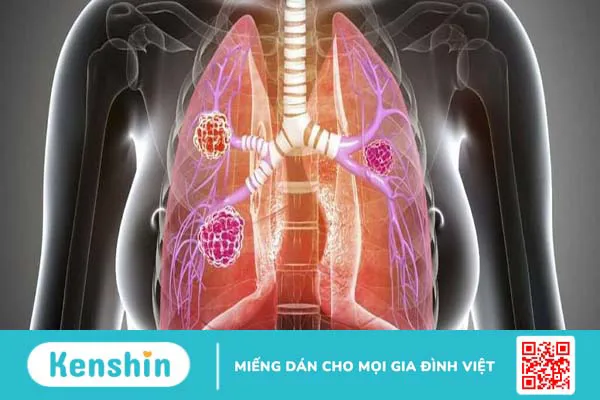 Vi khuẩn Burkholderia cepacia - Mầm bệnh gây nhiễm trùng bệnh viện 4