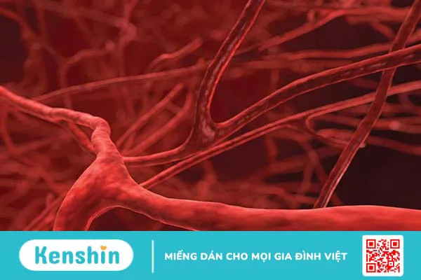 Vì sao ăn mặn bị nhức đầu? Dấu hiệu sức khỏe và biện pháp xử trí khi cơ thể dư thừa muối