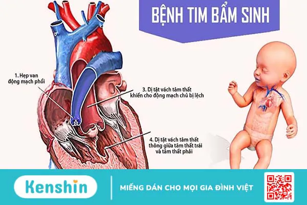 Vì sao cần thực hiện sàng lọc tim bẩm sinh? Các phương pháp sàng lọc tim bẩm sinh hiện nay