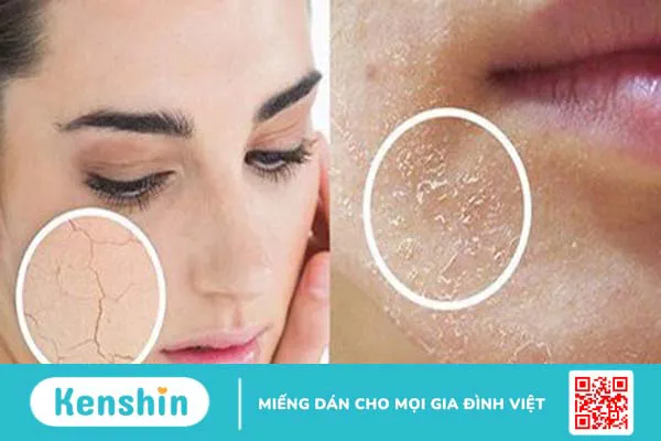 Vì sao ngồi máy lạnh bị khô da và giải pháp khắc phục