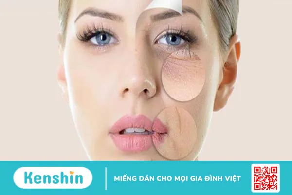 Vì sao người gầy nhưng mặt béo? Một số cách làm giảm béo mặt một cách tự nhiên