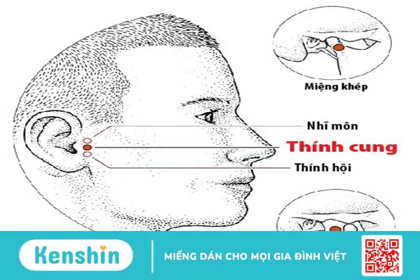 Vị trí của huyệt Thính Cung ở đâu trên cơ thể?