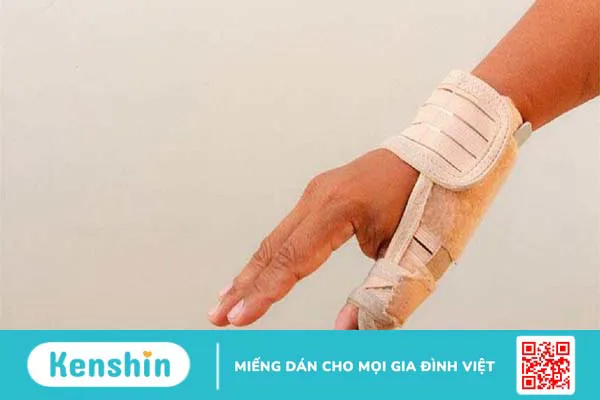 Viêm bao gân mỏm trâm quay cổ tay: Nguyên nhân, chẩn đoán và điều trị