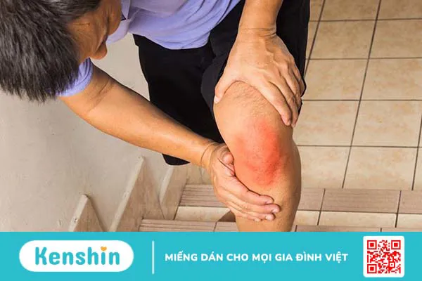 Viêm cơ tứ đầu đùi: Dấu hiệu, nguyên nhân và điều trị