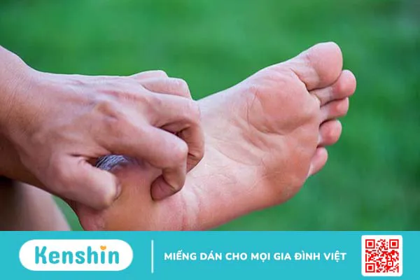 Viêm da cơ địa ở chân là gì? Cách nhận biết và điều trị bằng Đông y 1