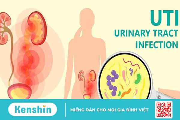 Viêm đường tiết niệu khám ở khoa nào, bệnh viện nào? 1