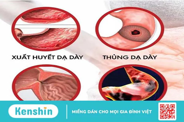 Viêm loét dạ dày uống nước gì và tránh ăn gì?