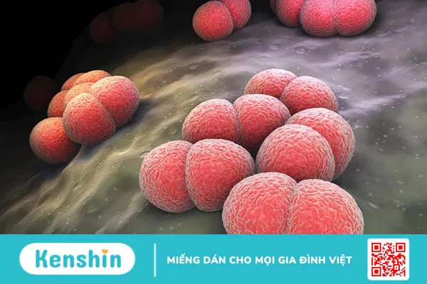 Viêm màng não do não mô cầu: Giải đáp các câu hỏi thường gặp cùng bác sĩ Nguyễn Văn My