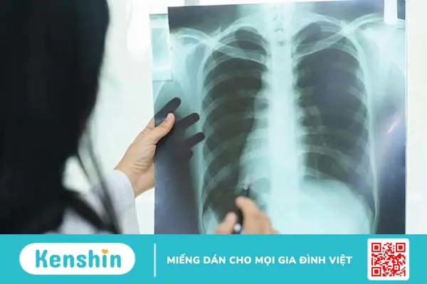 Viêm phổi cộng đồng ở người lớn: Giải đáp các câu hỏi thường gặp cùng bác sĩ Nguyễn Văn My 2