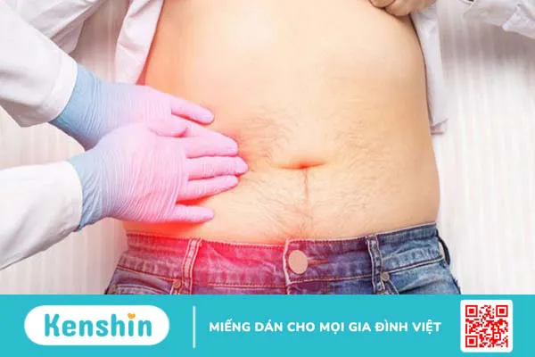 Viêm túi mật do sỏi: Căn bệnh nguy hiểm, cần phát hiện kịp thời